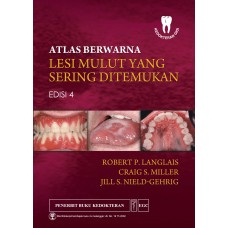 Buku Atlas Berwarna Lesi Mulut yang Sering Ditemukan Edisi 4
