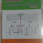 Buku Elektrokardiografi Ilustratif